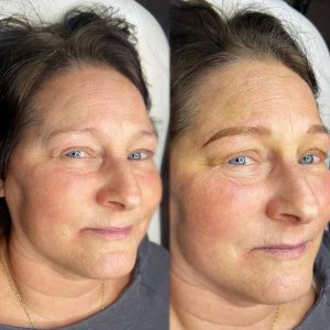 Microblading